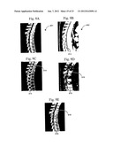 Assessment of Spinal Anatomy diagram and image