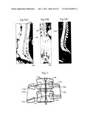 Assessment of Spinal Anatomy diagram and image