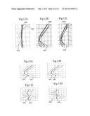 Assessment of Spinal Anatomy diagram and image