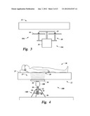 DEVICE AND METHOD FOR TREATING NOCTURIA diagram and image