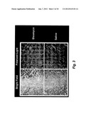 METHOD AND DEVICE FOR TREATING MICROSCOPIC TUMORS REMAINING IN TISSUES     FOLLOWING SURGICAL RESECTION diagram and image