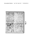 METHOD AND DEVICE FOR TREATING MICROSCOPIC TUMORS REMAINING IN TISSUES     FOLLOWING SURGICAL RESECTION diagram and image