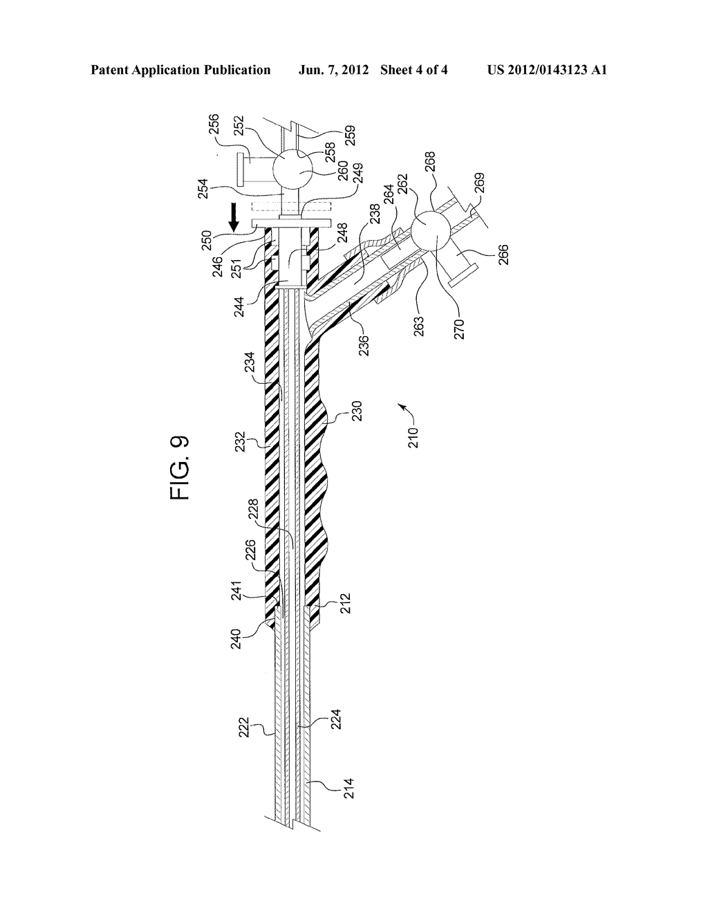 DIALYSIS CATHETER - diagram, schematic, and image 05