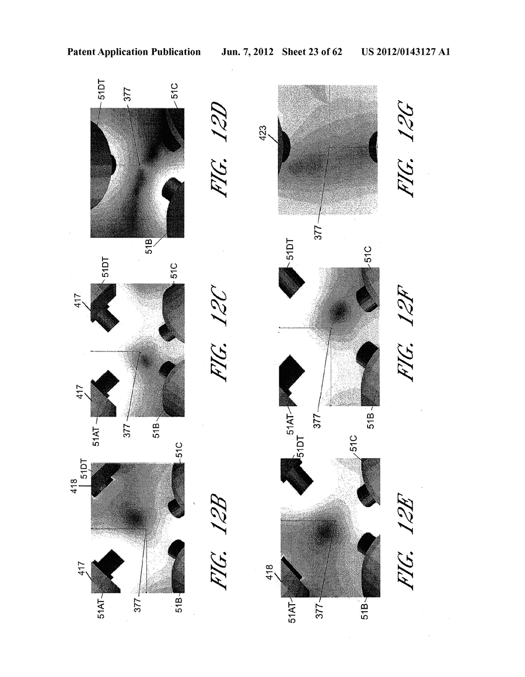 APPARATUS AND METHOD FOR SHAPED MAGNETIC FIELD CONTROL FOR CATHETER,     GUIDANCE, CONTROL, AND IMAGING - diagram, schematic, and image 24