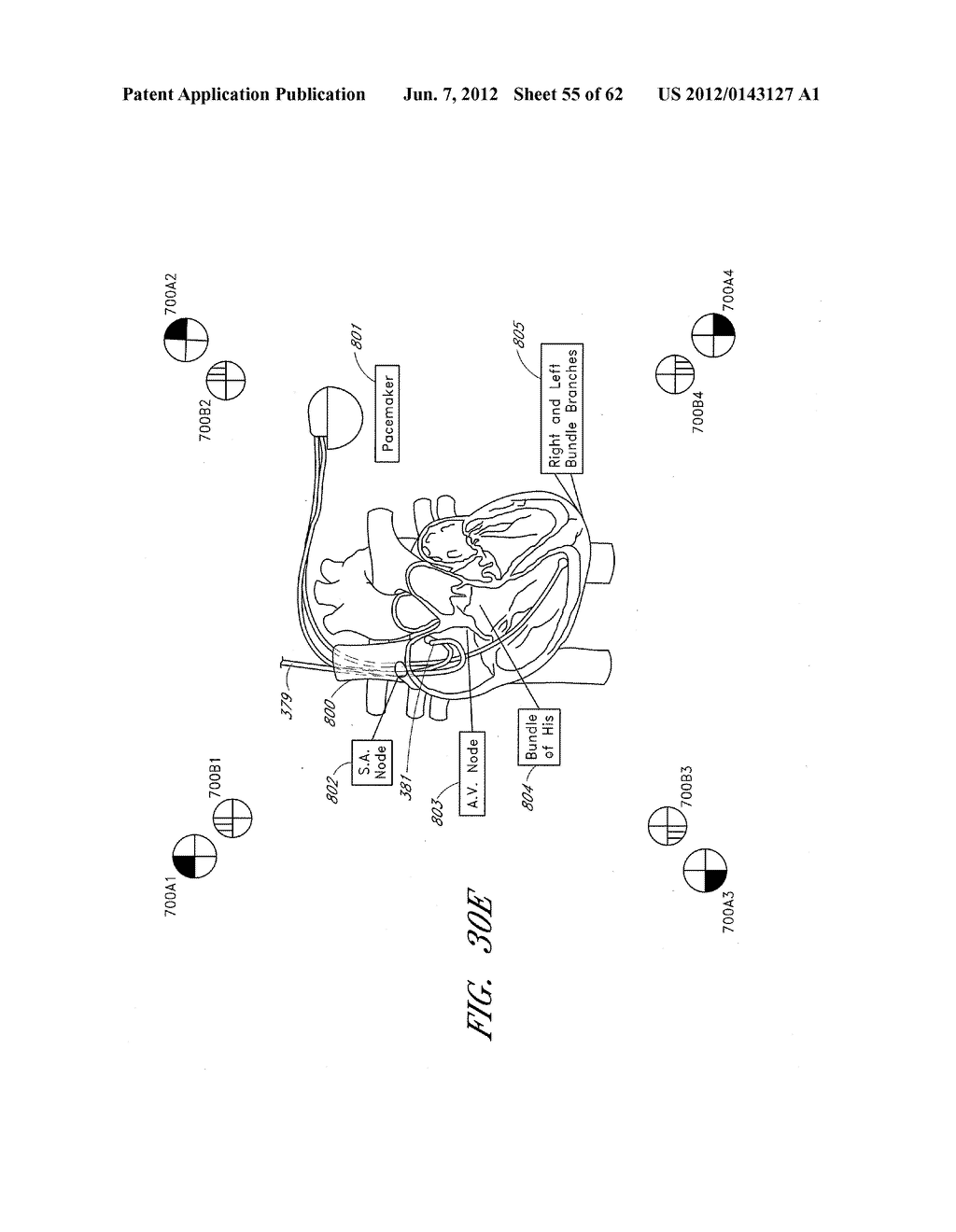 APPARATUS AND METHOD FOR SHAPED MAGNETIC FIELD CONTROL FOR CATHETER,     GUIDANCE, CONTROL, AND IMAGING - diagram, schematic, and image 56