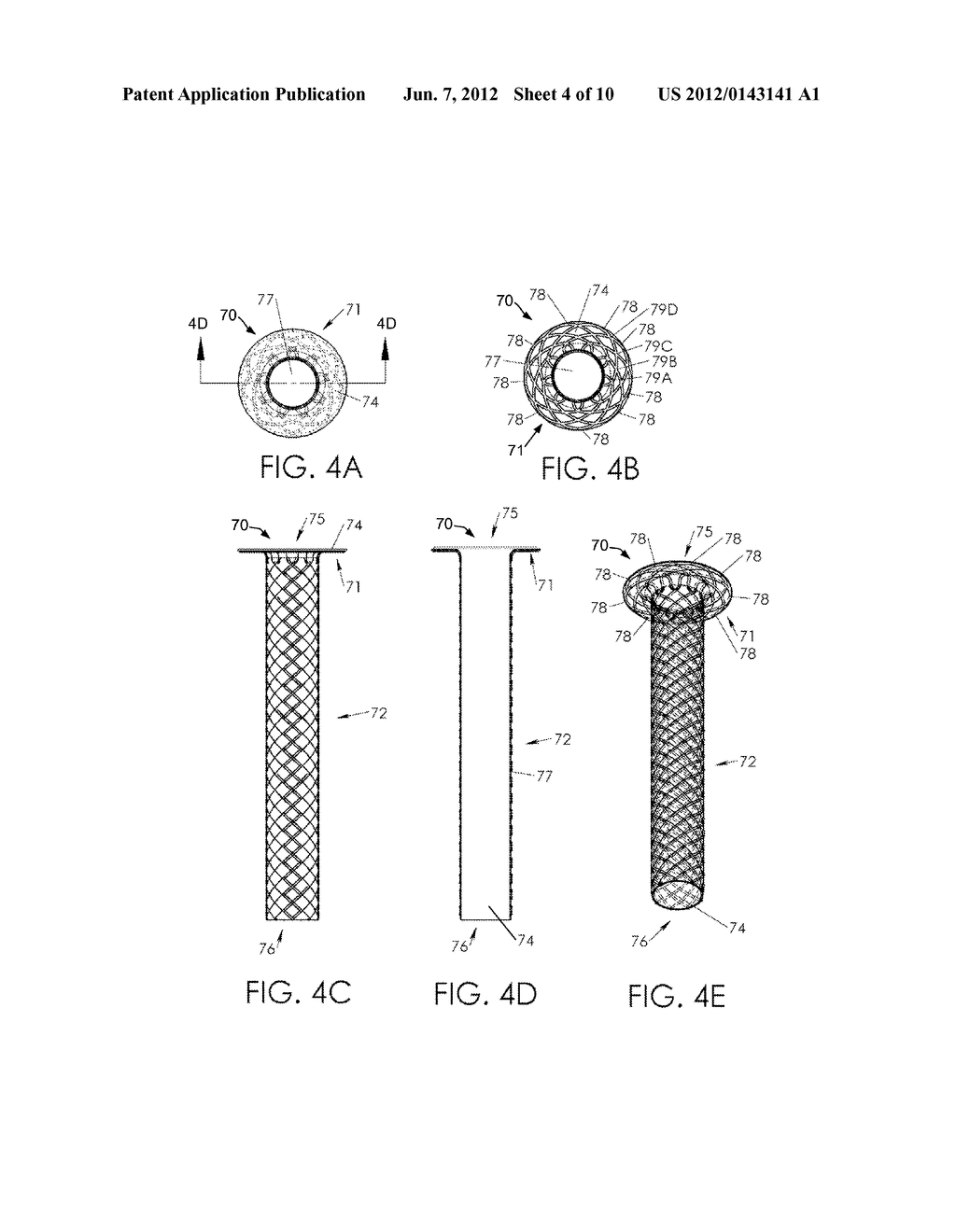 CONFORMAL CANNULA DEVICE AND RELATED METHODS - diagram, schematic, and image 05