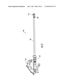 SURGICAL TOOL diagram and image