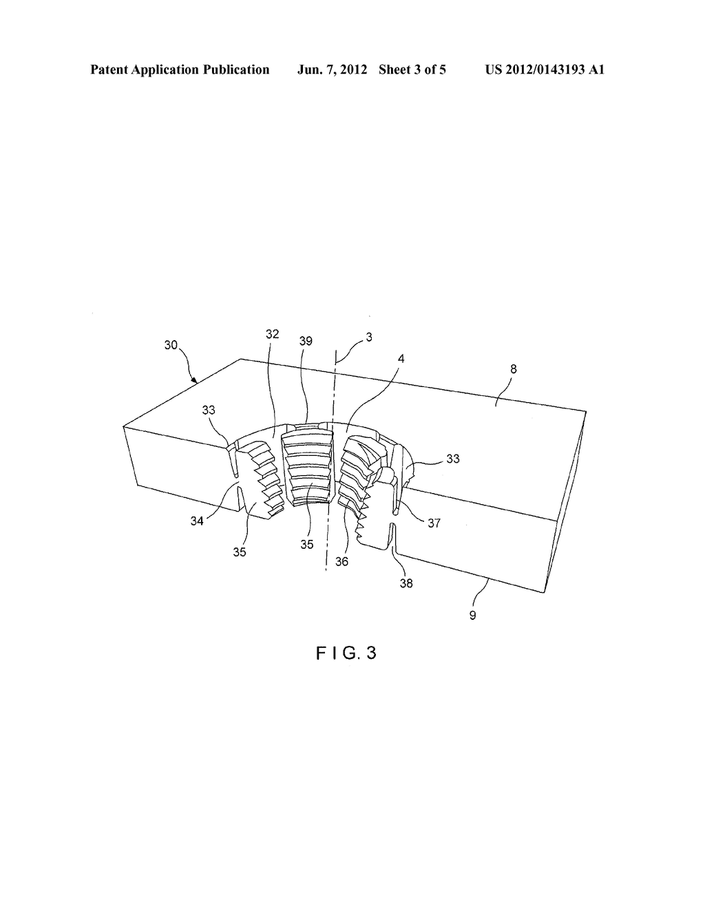 Device for Osteosynthesis - diagram, schematic, and image 04