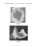 Surgical Tools for Arthroplasty diagram and image