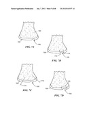 Surgical Tools for Arthroplasty diagram and image