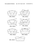 Surgical Tools for Arthroplasty diagram and image