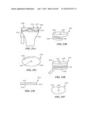 Surgical Tools for Arthroplasty diagram and image