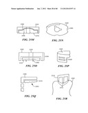 Surgical Tools for Arthroplasty diagram and image