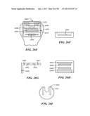 Surgical Tools for Arthroplasty diagram and image