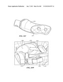 Surgical Tools for Arthroplasty diagram and image