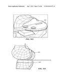 Surgical Tools for Arthroplasty diagram and image