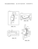 Surgical Tools for Arthroplasty diagram and image