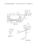 Surgical Tools for Arthroplasty diagram and image