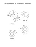 Surgical Tools for Arthroplasty diagram and image