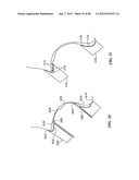 Surgical Tools for Arthroplasty diagram and image