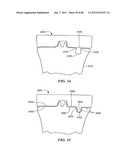 Surgical Tools for Arthroplasty diagram and image