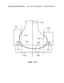 Surgical Tools for Arthroplasty diagram and image