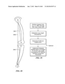 Surgical Tools for Arthroplasty diagram and image