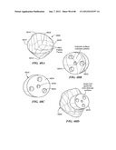 Surgical Tools for Arthroplasty diagram and image