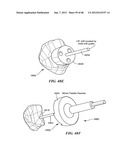 Surgical Tools for Arthroplasty diagram and image