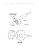 Surgical Tools for Arthroplasty diagram and image