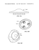 Surgical Tools for Arthroplasty diagram and image