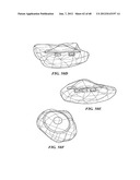 Surgical Tools for Arthroplasty diagram and image