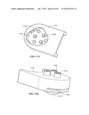 Surgical Tools for Arthroplasty diagram and image