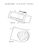 Surgical Tools for Arthroplasty diagram and image