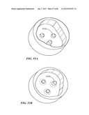 Surgical Tools for Arthroplasty diagram and image