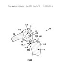 POSITIONING GUIDE AND A FEMUR BONE CUTTING GUIDE SYSTEM diagram and image