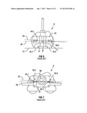 POSITIONING GUIDE AND A FEMUR BONE CUTTING GUIDE SYSTEM diagram and image