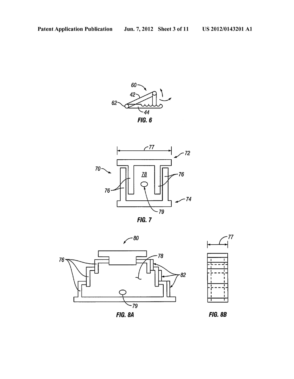 Devices and Methods for Treating Bone - diagram, schematic, and image 04