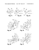 SYSTEMS AND METHODS FOR SUTURE PASSAGE diagram and image