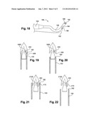 SYSTEMS AND METHODS FOR SUTURE PASSAGE diagram and image