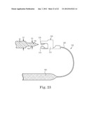 SUTURE SYSTEM AND ASSEMBLY diagram and image