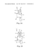 SUTURE SYSTEM AND ASSEMBLY diagram and image