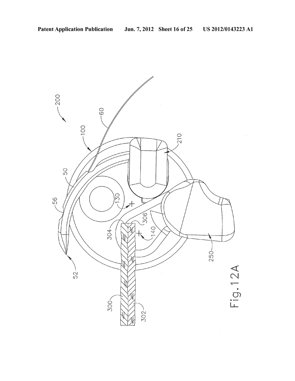 LAPAROSCOPIC SUTURING INSTRUMENT WITH PERPENDICULAR ECCENTRIC NEEDLE     MOTION - diagram, schematic, and image 17