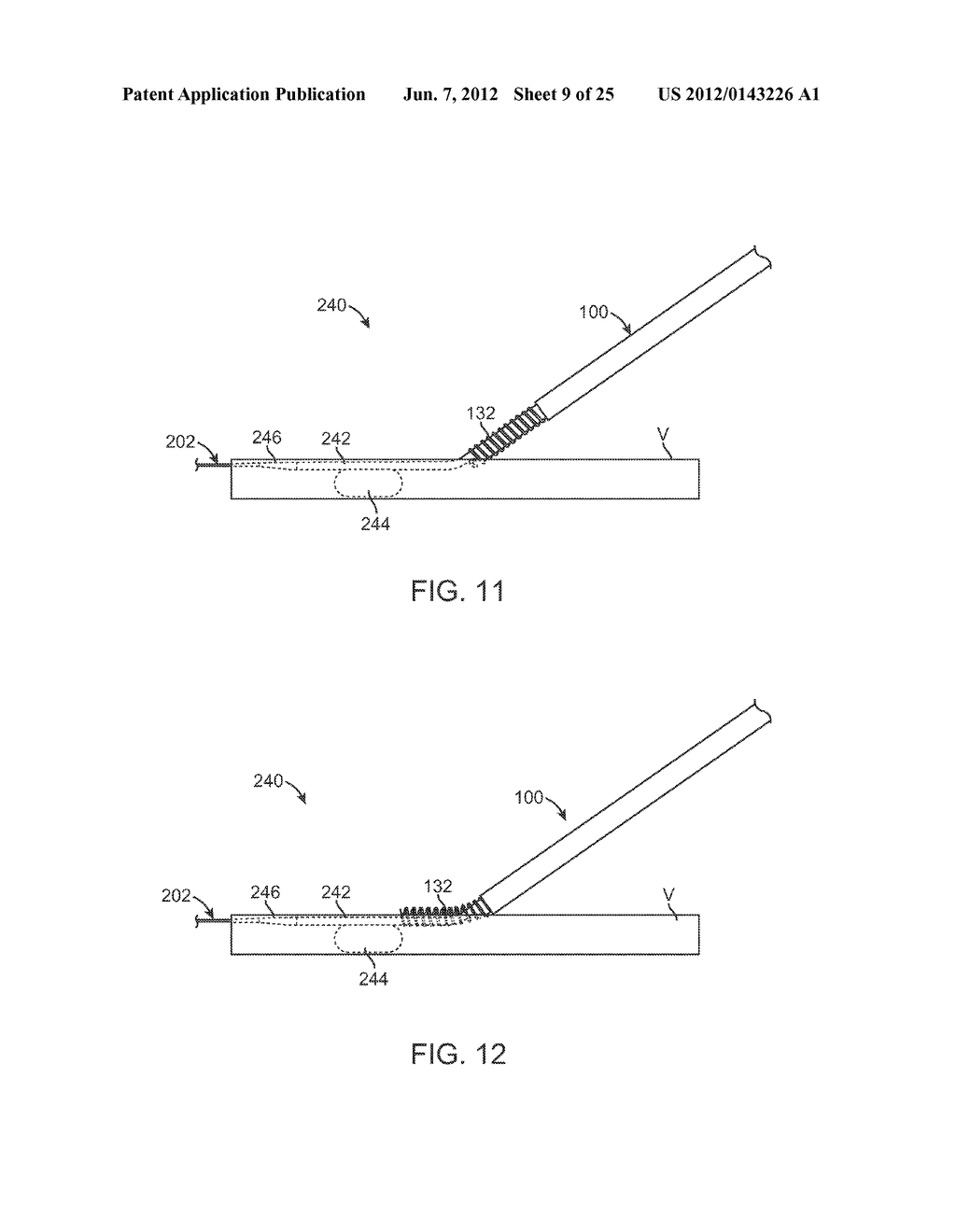 VESSEL ACCESS AND CLOSURE DEVICE - diagram, schematic, and image 10