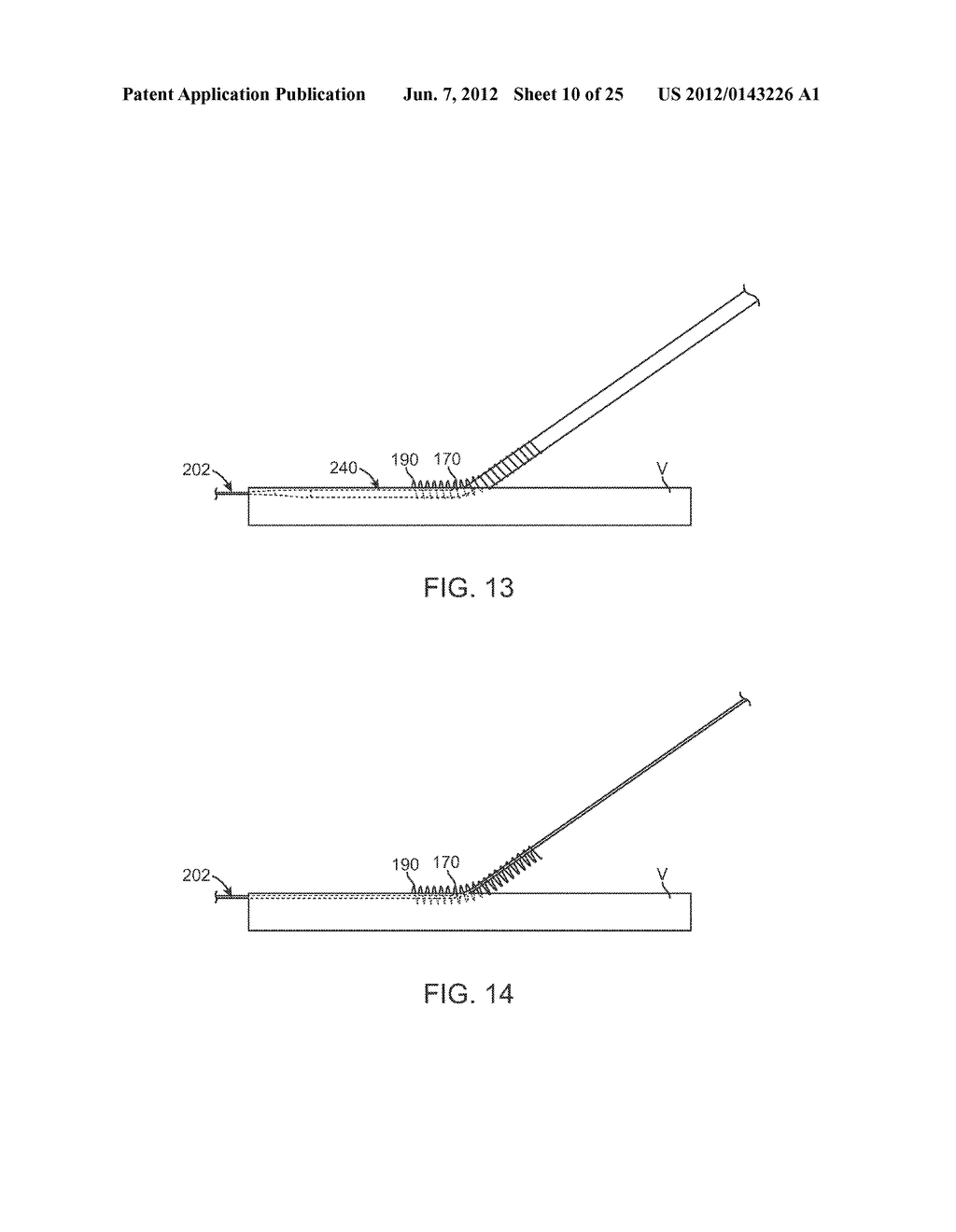 VESSEL ACCESS AND CLOSURE DEVICE - diagram, schematic, and image 11