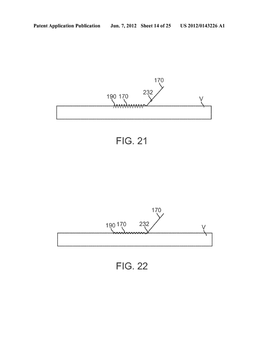 VESSEL ACCESS AND CLOSURE DEVICE - diagram, schematic, and image 15