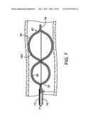 SYSTEMS, METHODS AND DEVICES FOR REMOVING OBSTRUCTIONS FROM A BLOOD VESSEL diagram and image