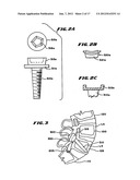 Facet Arthroplasty Devices and Methods diagram and image