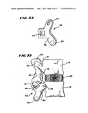 Facet Arthroplasty Devices and Methods diagram and image