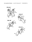 Facet Arthroplasty Devices and Methods diagram and image